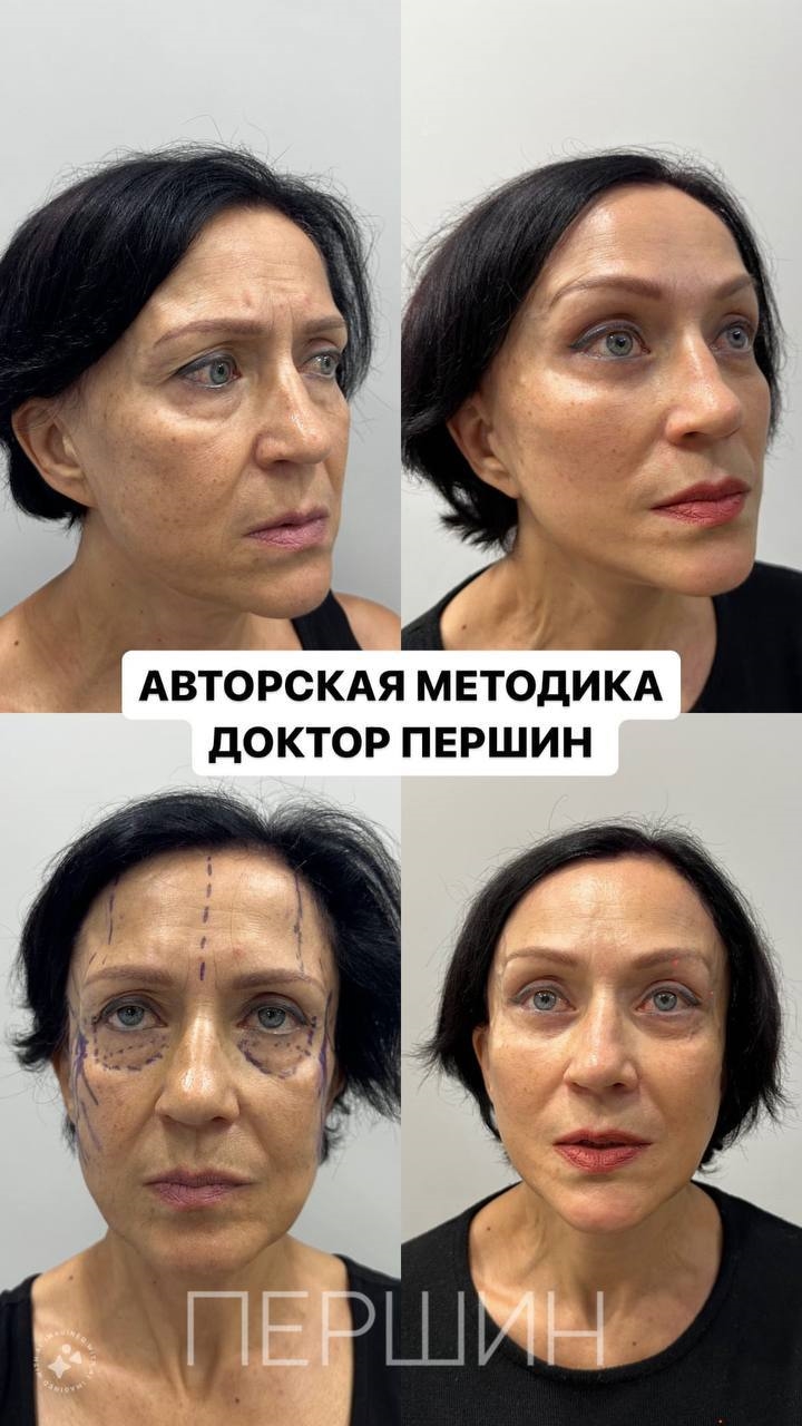 Операция на глаза калининград